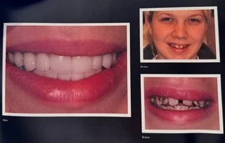 Dental transformation